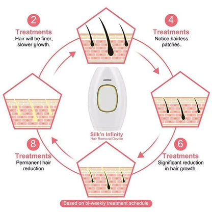 GlowSilk IPL Hair Removal Handset – Smooth Skin at Home